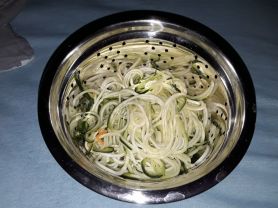 Zoodles Zucchini - Gemüsenudeln | Hochgeladen von: dalei0815