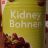 kidney bohnen von Wicki | Hochgeladen von: Wicki