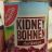 Kidney Bohnen, dunkelrot von Schalo | Hochgeladen von: Schalo